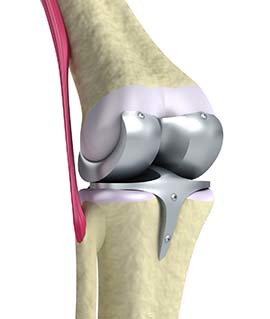 Reinforcement of the joints by using Hondrocream