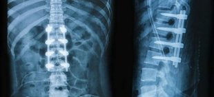 x-ray-back